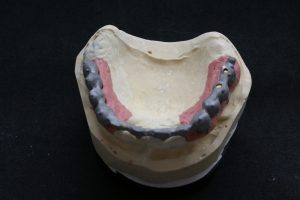 Tertiärkonstruktion